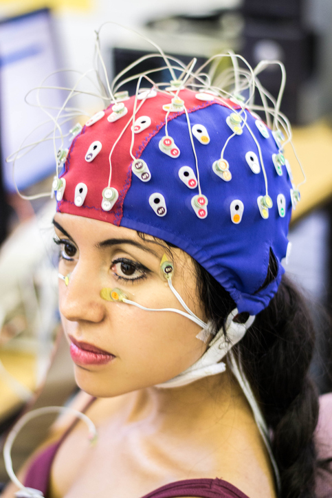 EEG para monitorizar a atividade cerebral. Fonte da fotografia: Getty Images Exame EEG de uma mulher, eléctrodos na cabeça