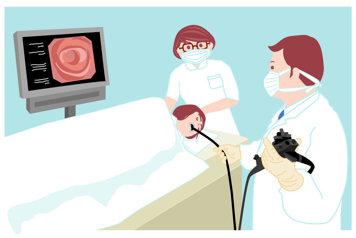 Exame endoscópico - Gastrofibroscopia com um endoscópio Fonte: Getty Images Exame endoscópico