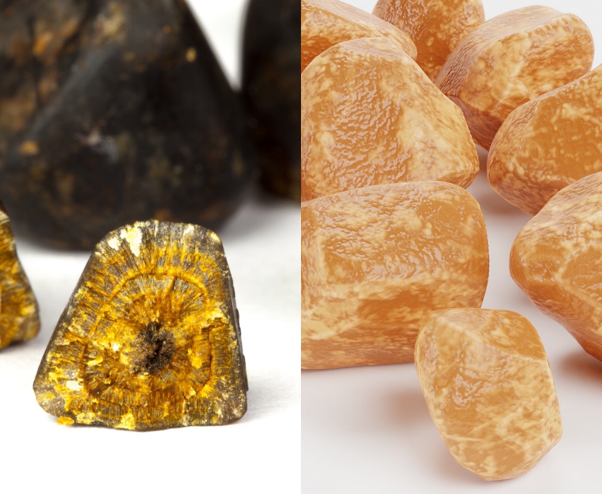 A figura mostra dois tipos de cálculos biliares: os cálculos biliares pretos, que resultam do excesso de bilirrubina na bílis, e os cálculos biliares amarelos, que resultam do excesso de colesterol na bílis: Getty Images Tipos de cálculos na vesícula biliar