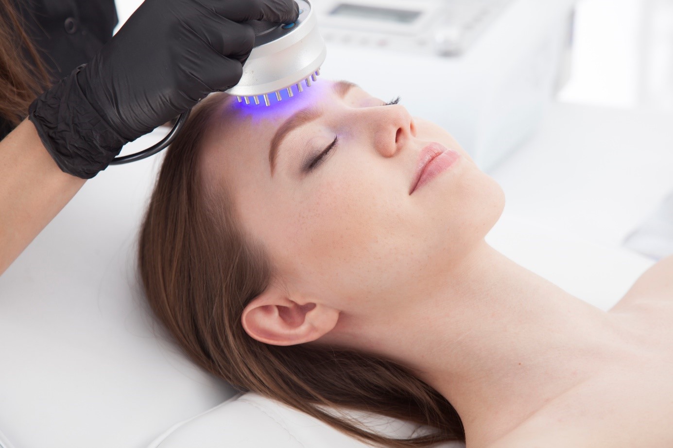 O tratamento profissional e supervisionado é importante: Getty Images Tratamento da acne