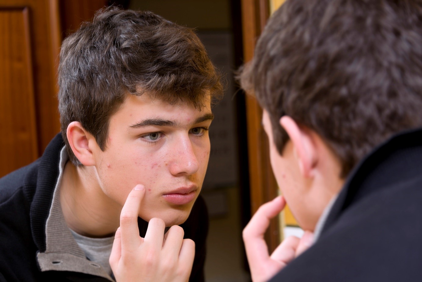 História familiar de acne = exame profissional Fonte: Getty Images Rapaz com acne no rosto