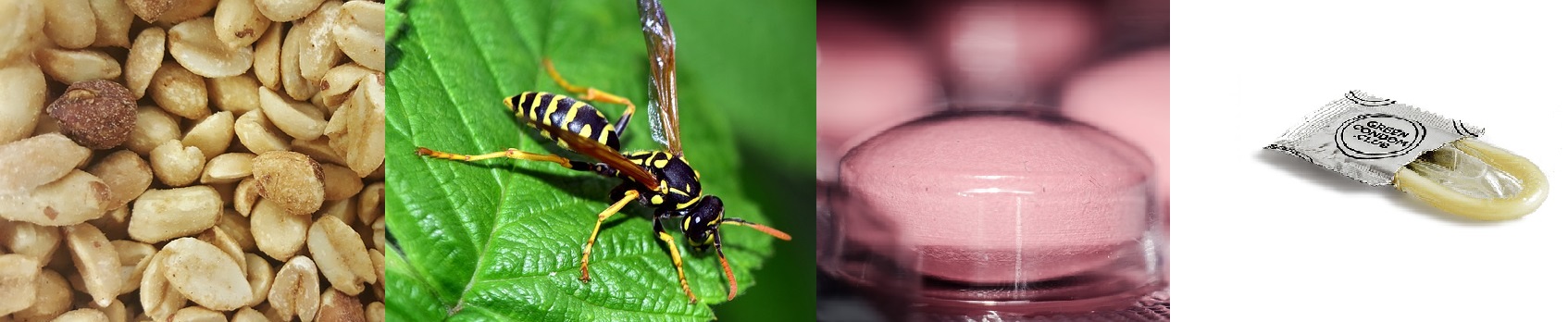 Os alergénios mais comuns - alimentos como os amendoins, veneno de vespa, medicamentos, látex: Getty Images alergias - alergénios mais comuns, frutos secos, veneno de vespa, medicamentos, látex
