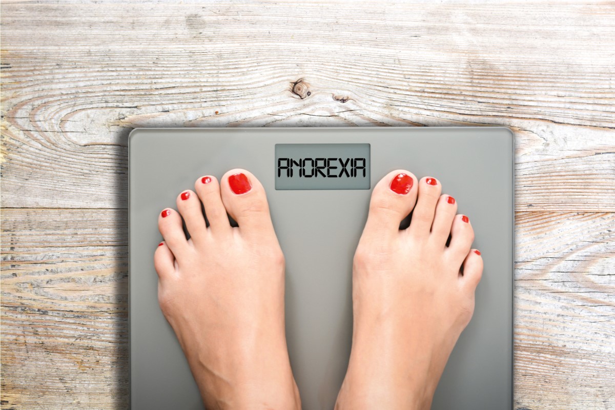 A anorexia é uma percepção do seu próprio peso elevado que não corresponde à realidade. A pessoa em questão não tem consciência da ameaça à sua saúde e à sua vida. Pés numa balança com a palavra anorexia escrita.