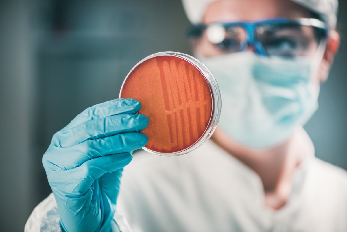 O método de cultura para testar a tosse convulsa só é adequado nas fases iniciais da doença e antes de iniciar o tratamento com antibióticos: Getty Images O método de cultura para testar a tosse convulsa só é adequado nas fases iniciais da doença e antes de iniciar o tratamento com antibióticos