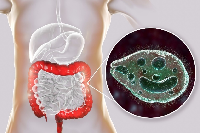 Balantidium coli - um parasita que infecta o intestino grosso do trato digestivo humano