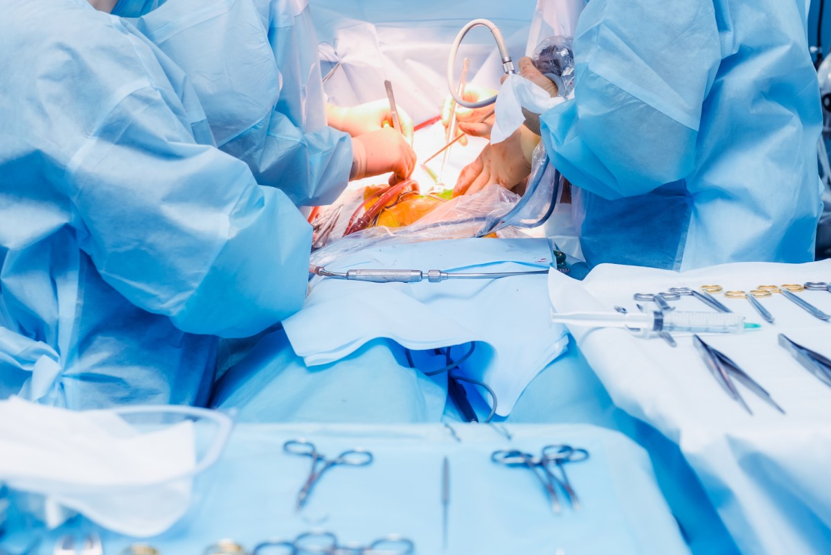 Tratamento cirúrgico - a cirurgia como uma das opções. Fonte da foto: Getty Images Tratamento cirúrgico - cirurgia abdominal e médicos e paramédicos na sala de operações operam o doente