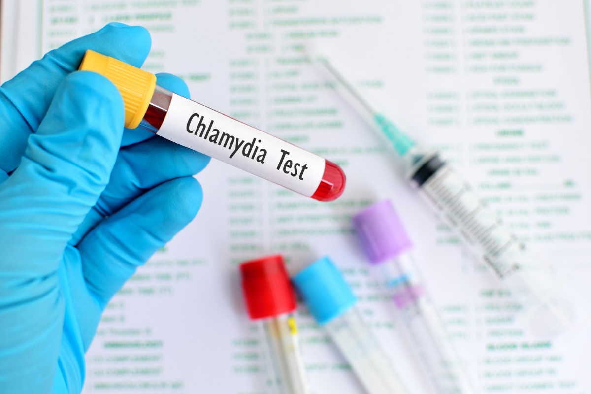 Atualmente, existem vários tipos de testes para detetar infecções por clamídia, sendo o mais utilizado o teste PCR. Fonte Getty Images Teste de clamídia - sangue num tubo de ensaio, mão enluvada a segurar o tubo de ensaio, tubo de ensaio no fundo, agulha