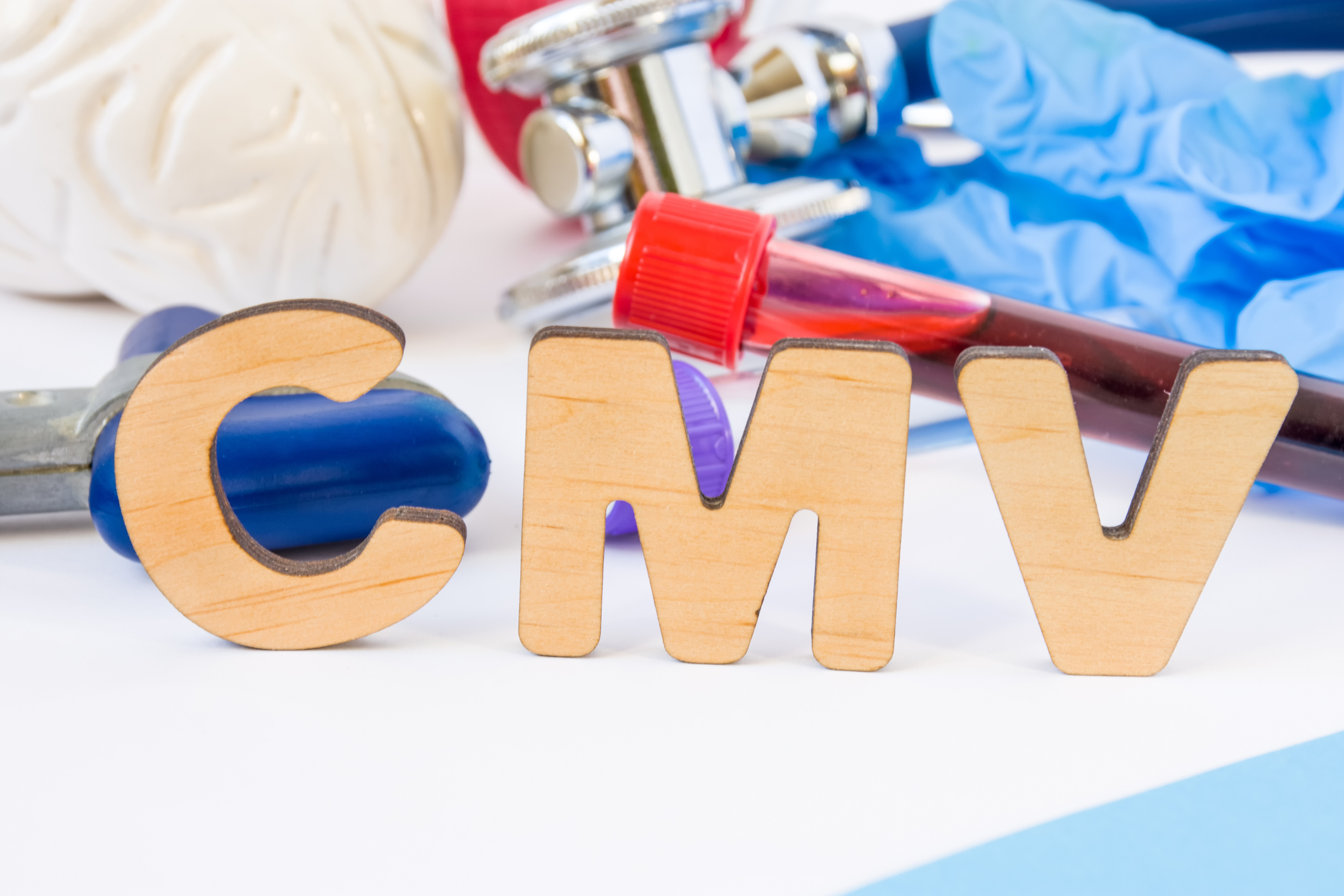 CMV significa citomegalovírus.