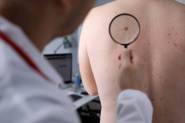 Dermatoscopia - exame das formações cutâneas