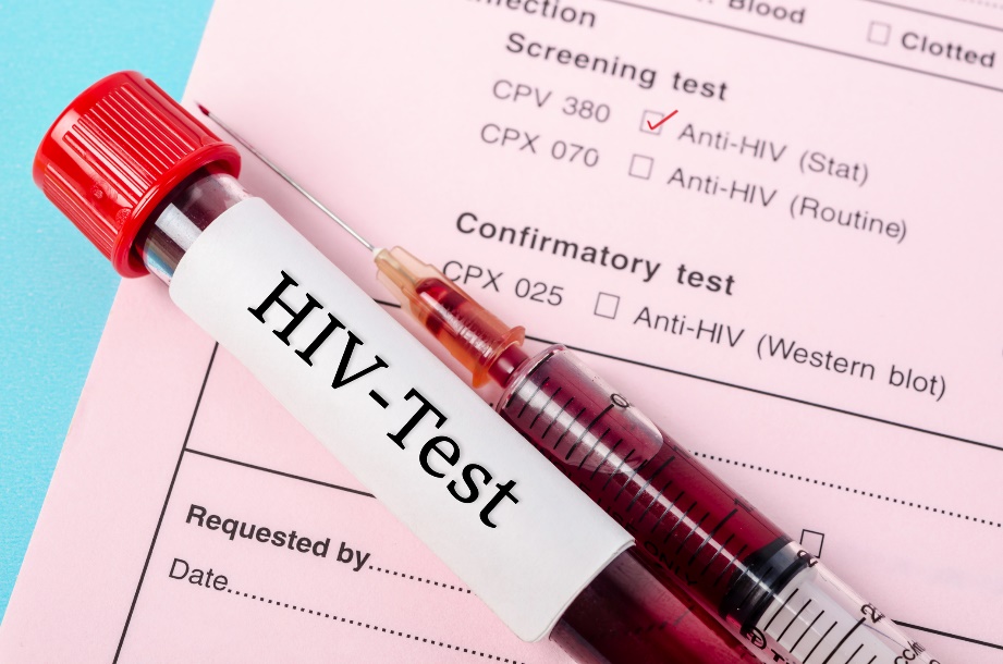 Um teste de diagnóstico para a presença de anticorpos anti-HIV numa amostra de sangue de um paciente: Getty Images Teste de diagnóstico da presença de anticorpos anti-VIH numa amostra de sangue de um doente