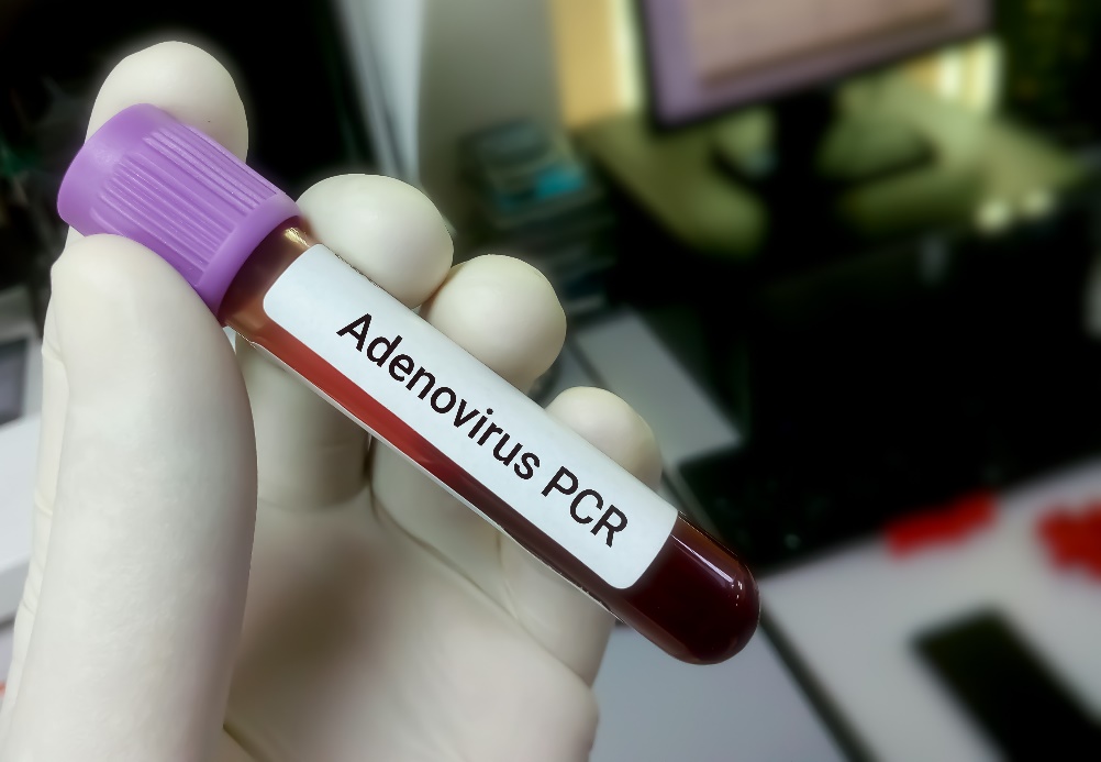 Diagnóstico da presença do vírus a partir de uma amostra de sangue de um doente
