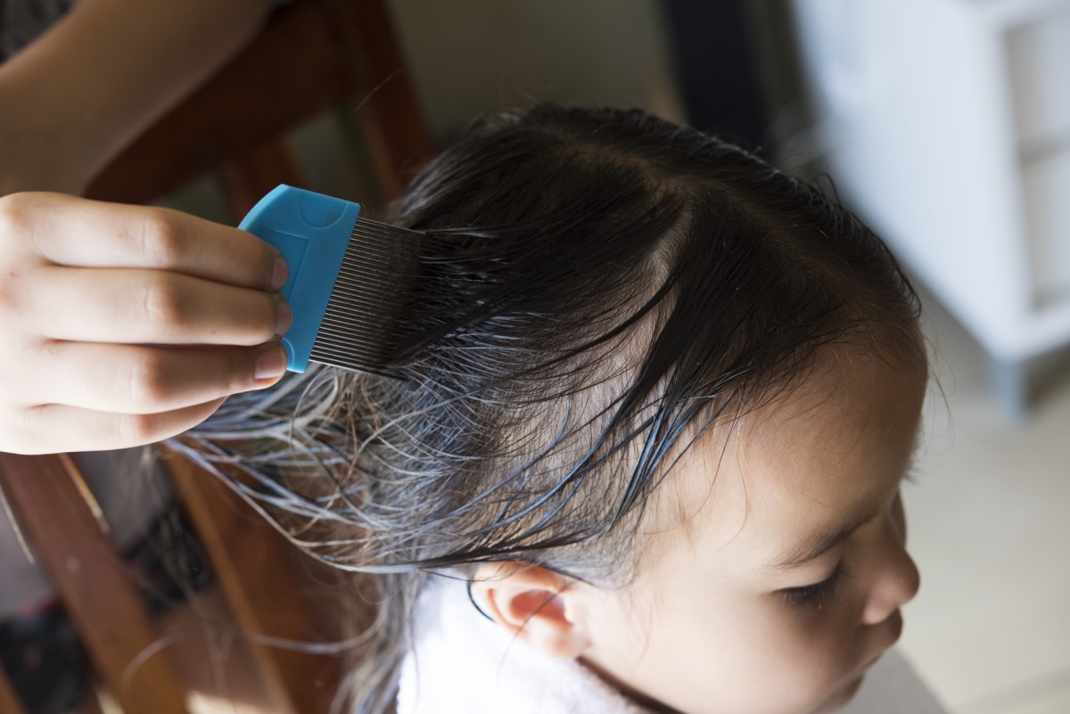 A eliminação dos piolhos pode ajudar os conselhos caseiros. Fonte: Getty Images Uma rapariga com o cabelo lavado e a pentear os piolhos com um pente especial concebido para o efeito.