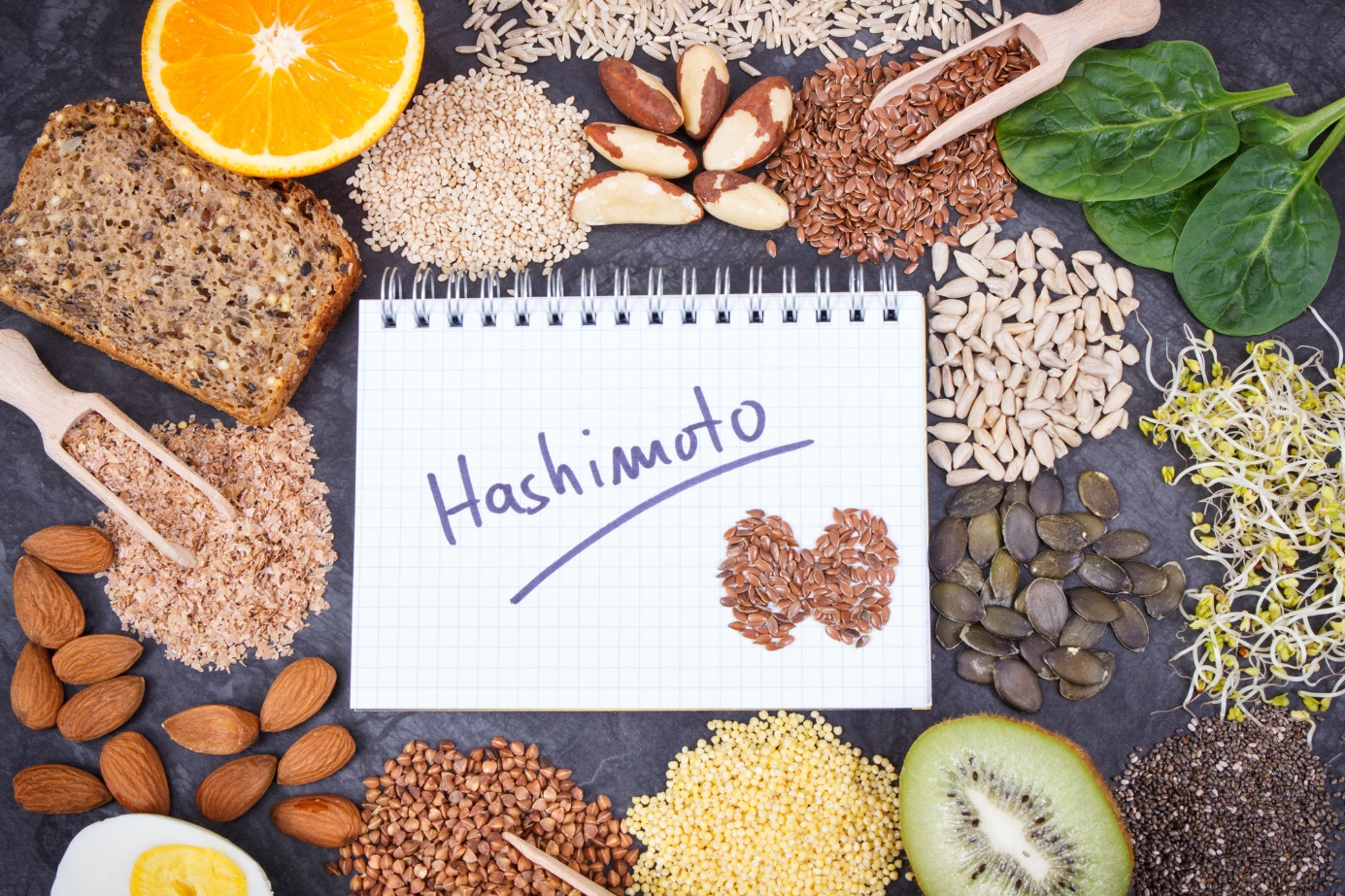 Tiroidite de Hashimoto e dieta adequada. Fonte da foto: Getty Images Tiroidite de Hashimoto e dieta adequada
