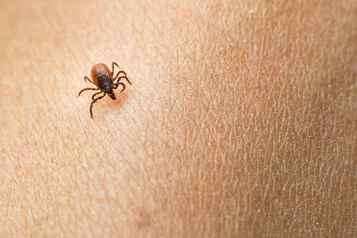 A doença de Lyme é transmitida ao ser humano por uma carraça. Fonte da foto: Getty Images Carraças que rastejam na pele