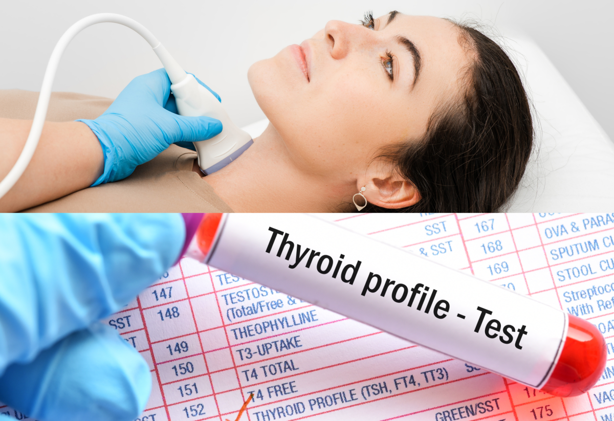 Exame da tiroide - SONO/USG + colheita de sangue e determinação dos níveis hormonais Fonte: Getty Images Exame da tiroide - colheita de sangue e níveis hormonais e SONO/USG