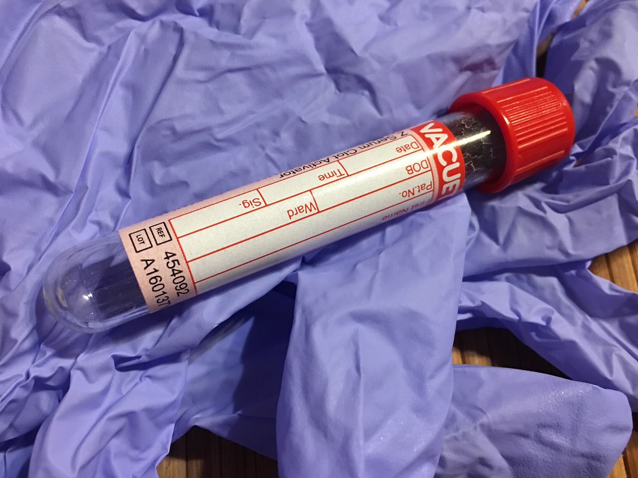 O diagnóstico é confirmado por análises ao sangue: Getty Images Tubo de sangue, luvas