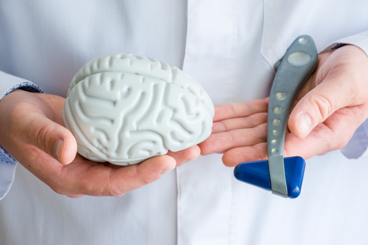 O diagnóstico precoce é importante: Getty Images Exame por um neurologista, o médico segura um modelo do cérebro e um exame neurológico com um martelo.