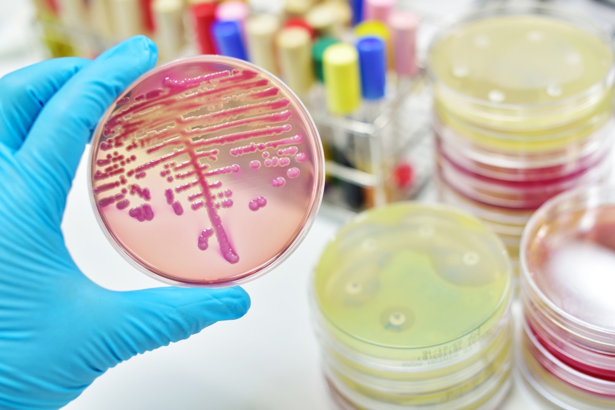 Colónias de bactérias - durante o exame microbiológico Fonte: Getty Images Exame microbiológico - cultura - colónias de bactérias