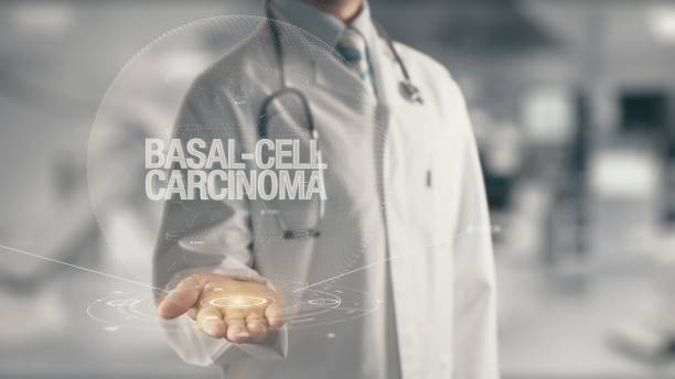 A mortalidade (taxa de mortalidade) por CBC é muito baixa