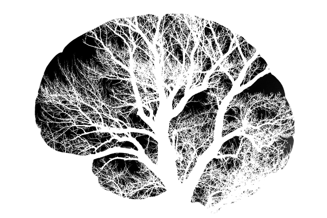 Forma de paralisia cerebral de acordo com o envolvimento do sistema nervoso Fonte: Getty Images Modelo cerebral