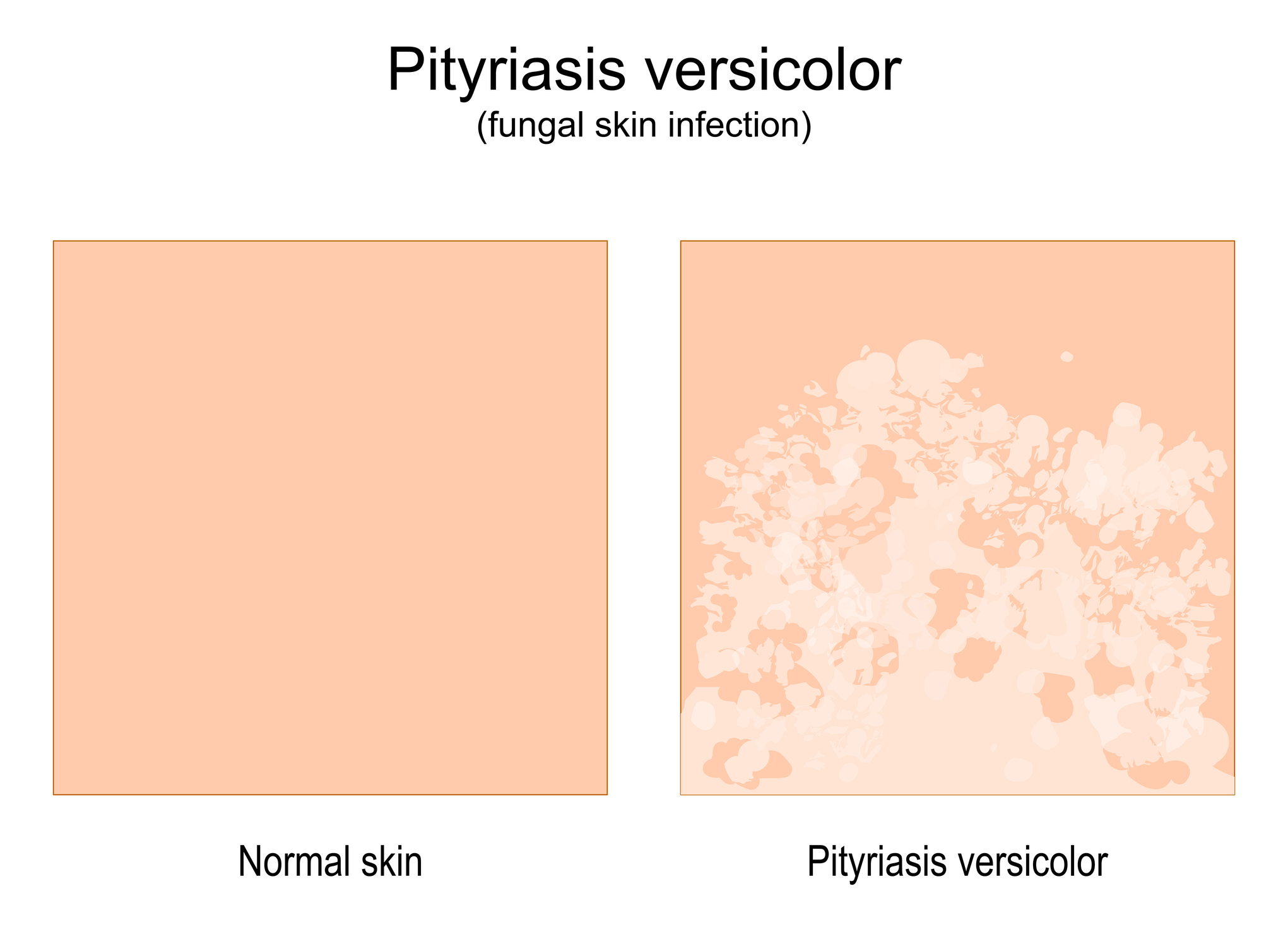 Comparação entre pele normal e pele com sinais de doença