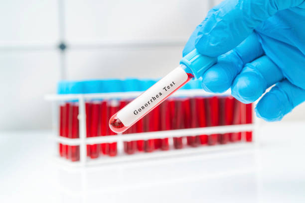 Colheita de sangue venoso (veia) para exame