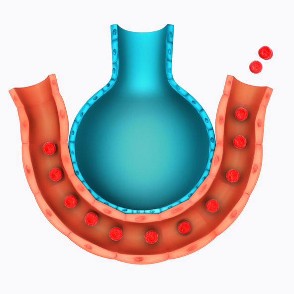 Falta de ar na disfunção da câmara pulmonar devido a inflamação. Fonte da foto: Getty Images Representação em modelo dos alvéolos e dos vasos pulmonares, trocas gasosas respiratórias