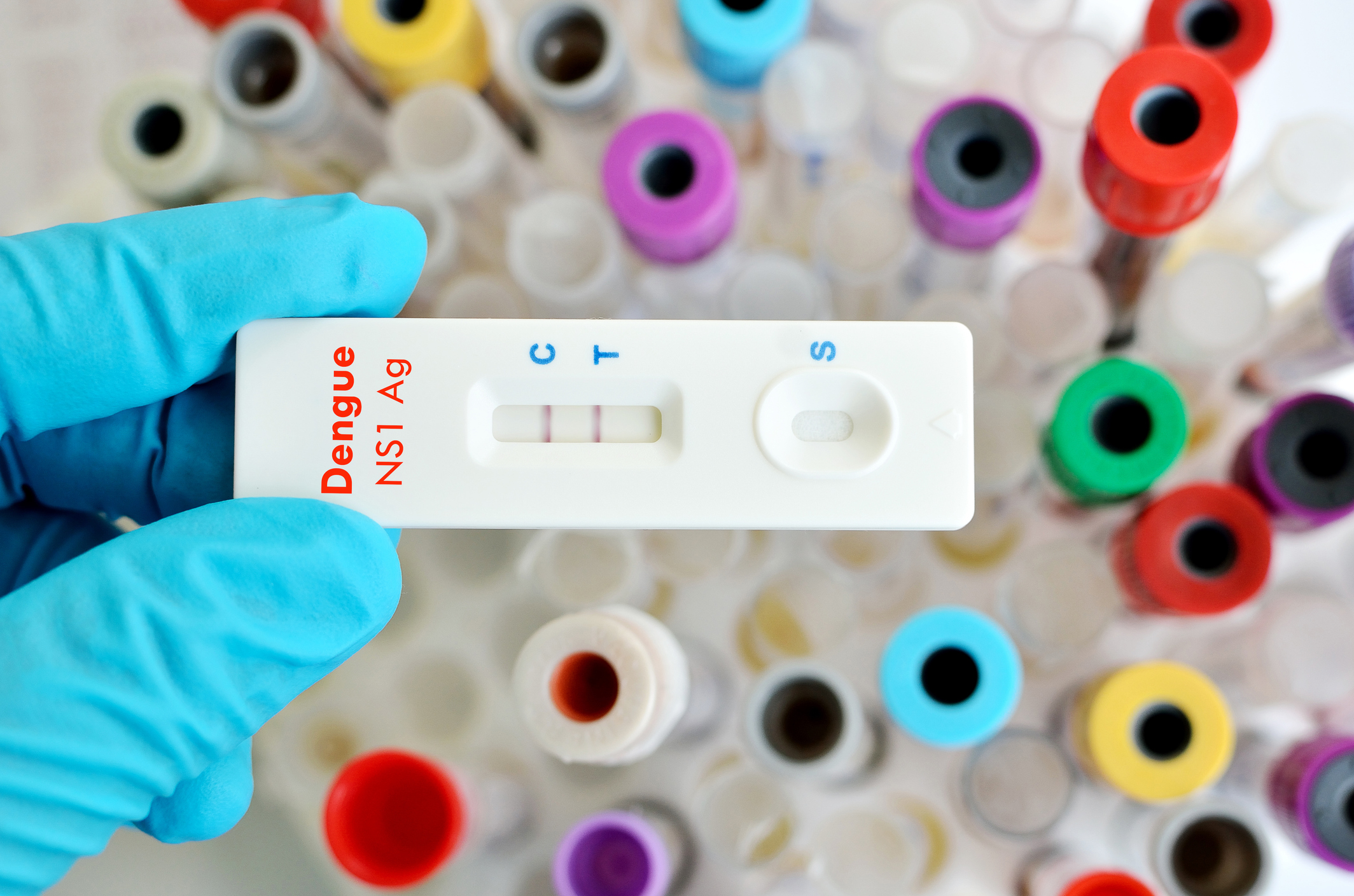 Este é o aspeto de um teste de dengue positivo. Fonte Getty Images Teste positivo para a febre de dengue
