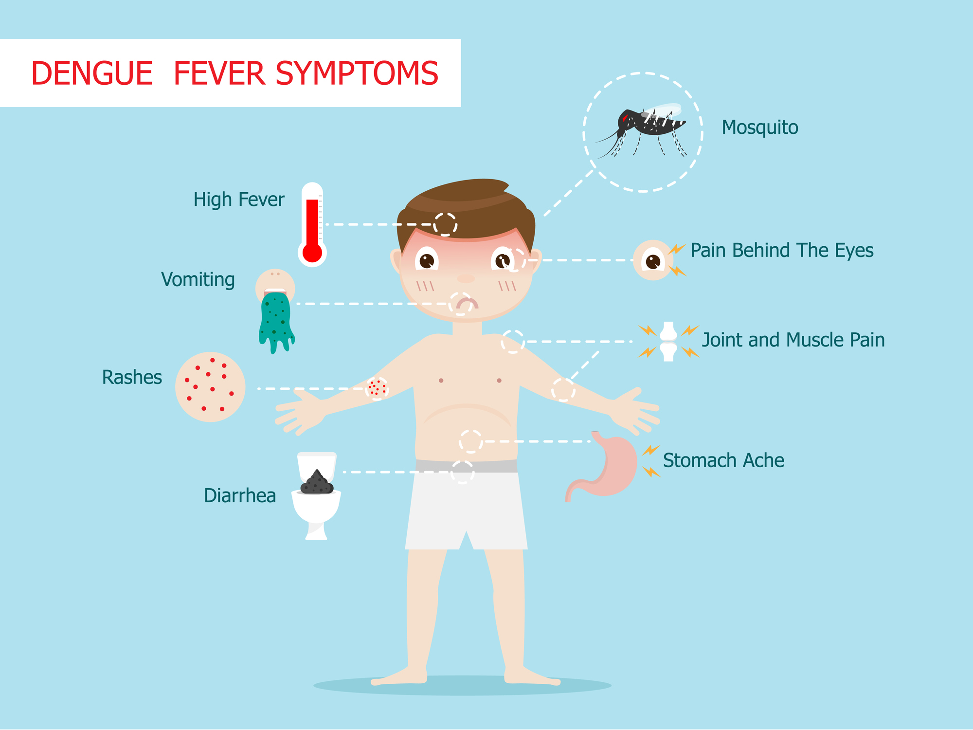 Sintomas da febre da dengue: febre alta, vómitos, erupção cutânea, diarreia, dor atrás dos olhos, dor nas articulações e nos músculos, dor de estômago: Getty Images Sintomas da febre da dengue