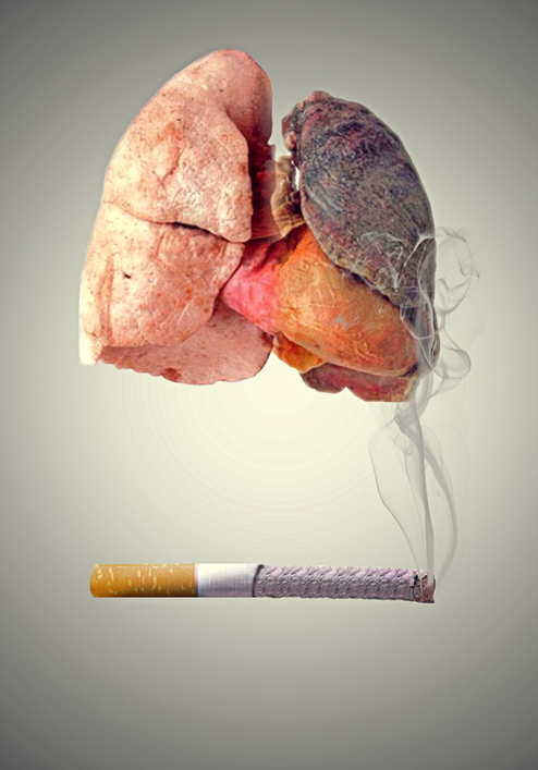 Getty Images Fumar danifica os pulmões e a laringe e é um agente cancerígeno. Fonte da foto: Pulmões destruídos pelo fumo e pelo cancro - uma representação simbólica