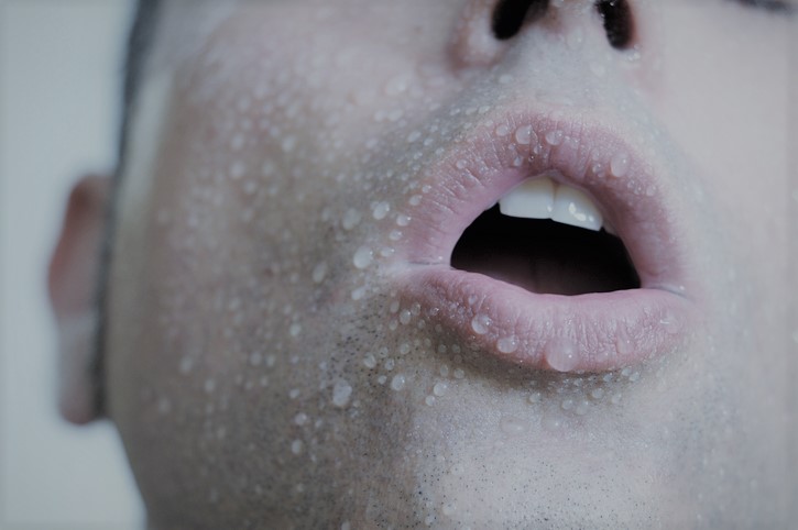 A manifestação é uma pele pálida com suor frio presente: Getty Images Choque - pele pálida e suada - rosto de um homem
