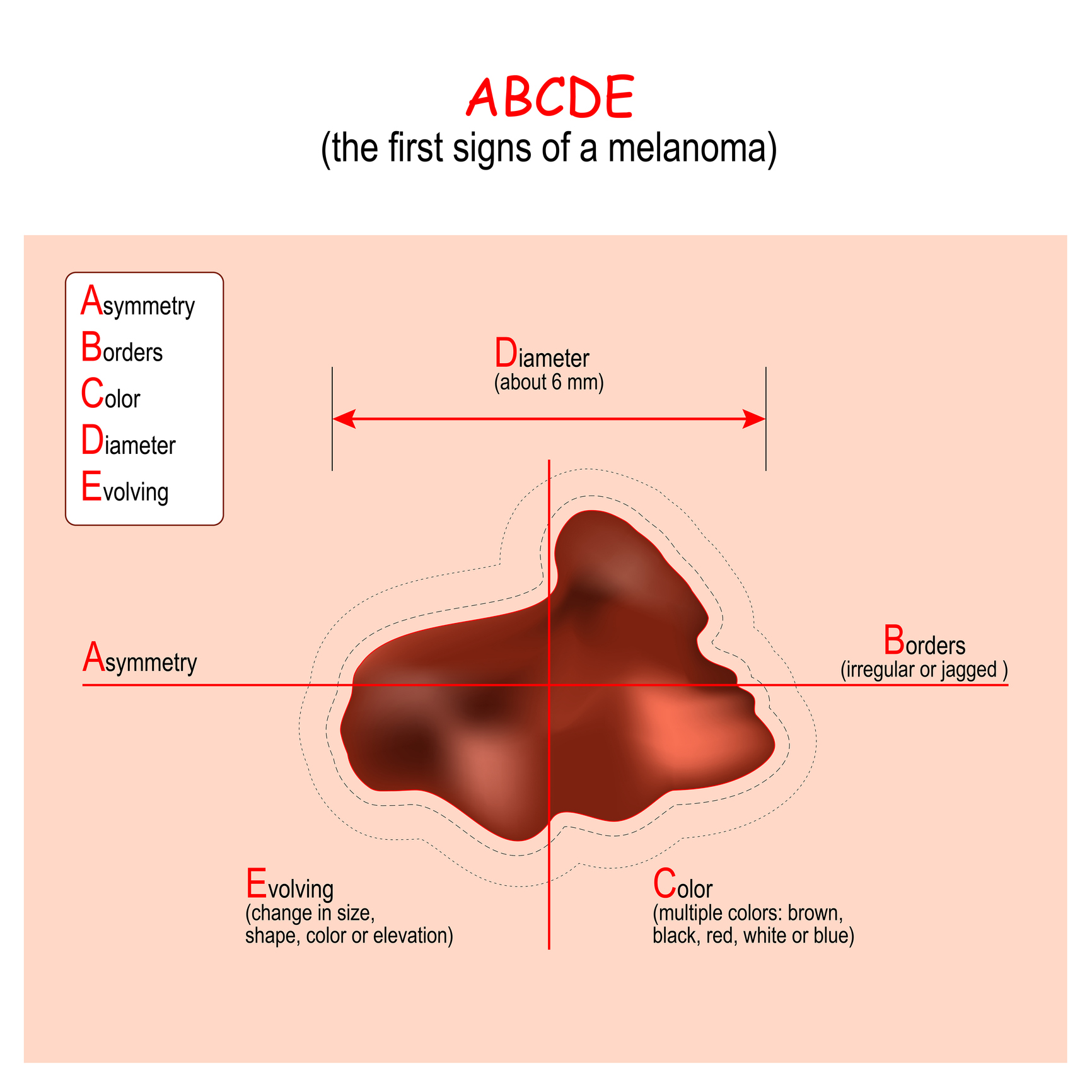 Algoritmo ABCDE. Fonte: Getty Images Algoritmo ABCDE