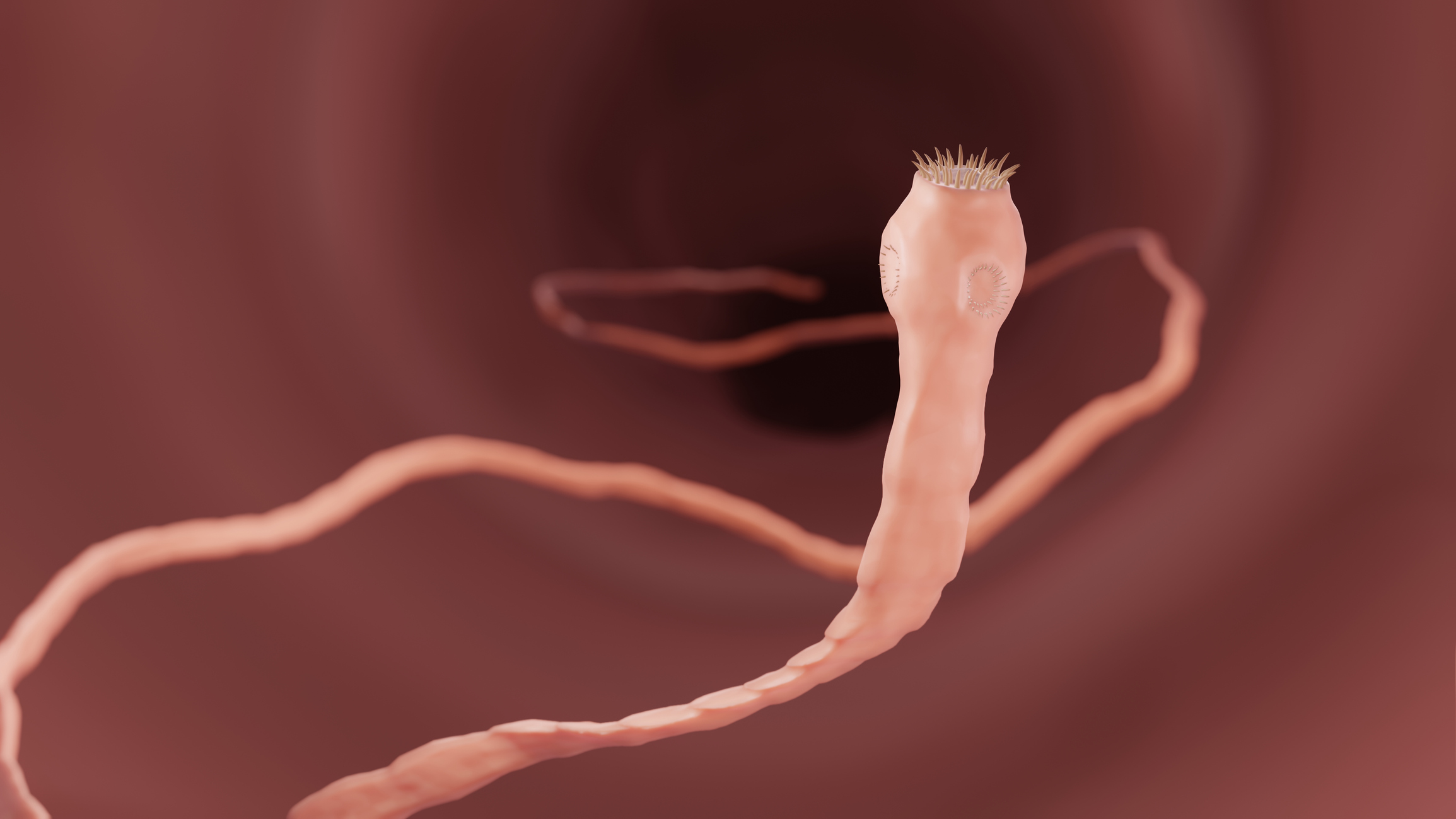 Teníase - a ténia como agente causador de doenças e problemas de saúde - parasita intestinal. Fonte Getty Images Teníase, ténia