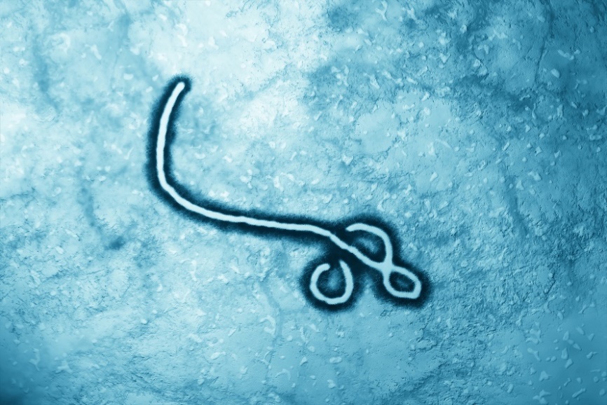 O vírus do Ébola ao microscópio. Fonte: Getty Images O vírus do Ébola ao microscópio