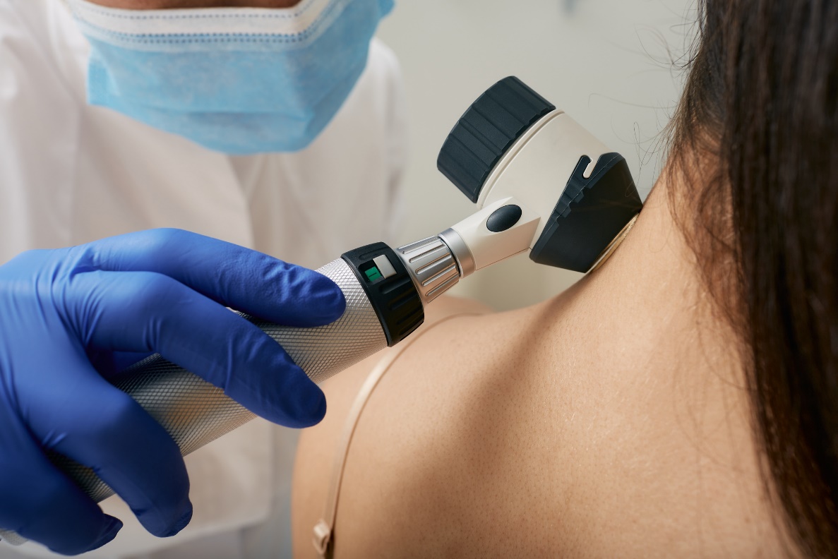 Exame médico de formações cutâneas com um dermatoscópio. Fonte: Getty Images Exame médico das formações cutâneas com um dermascópio