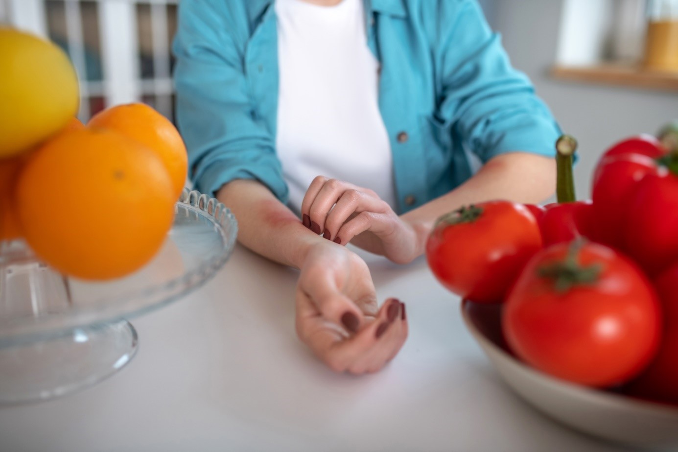 As causas podem ser diferentes: Getty Images Uma mulher tem urticária depois de comer fruta ou legumes e coça o antebraço
