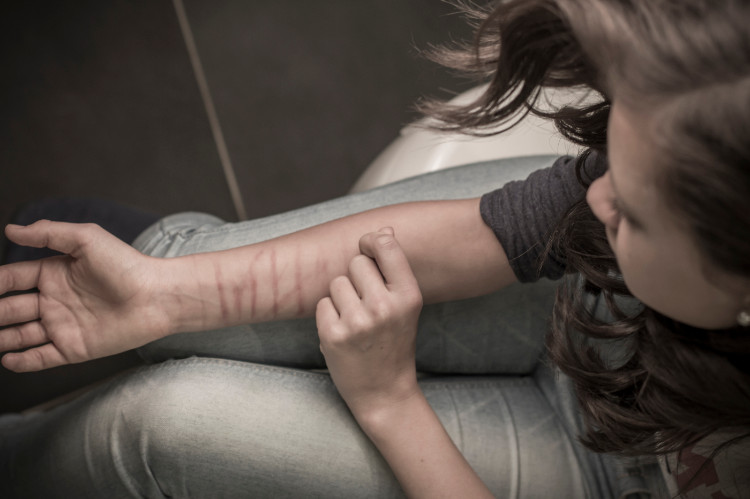 A automutilação é um fenómeno patológico. Fonte: Getty Images uma jovem mulher corta o antebraço com um objeto afiado