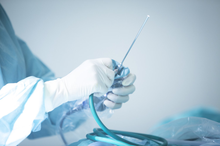 Opções de tratamento instrumental para hemorróidas Fonte: Getty Images a mão do médico a segurar o endoscópio
