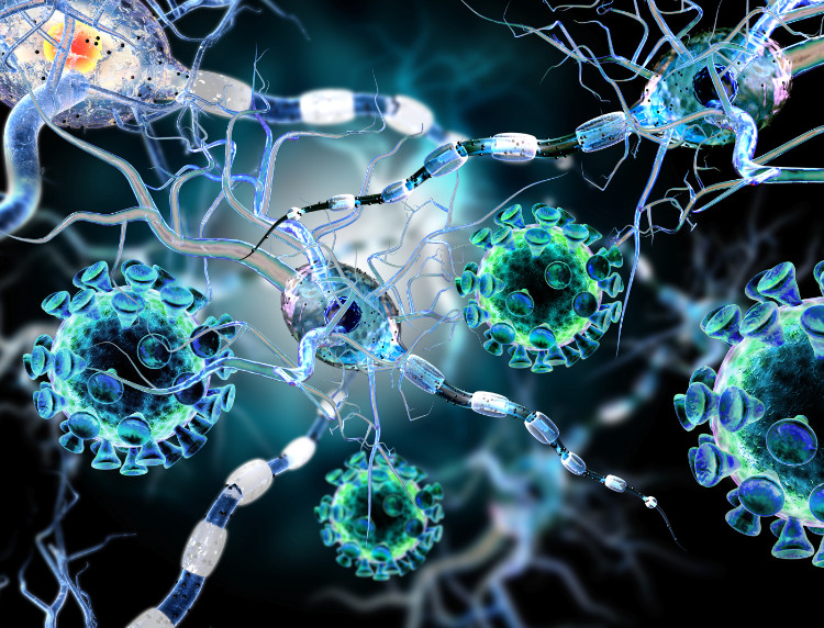 Doenças auto-imunes, neurónios na imagem Fonte: thinkstock photo representação microscópica das células do sistema nervoso dos neurónios