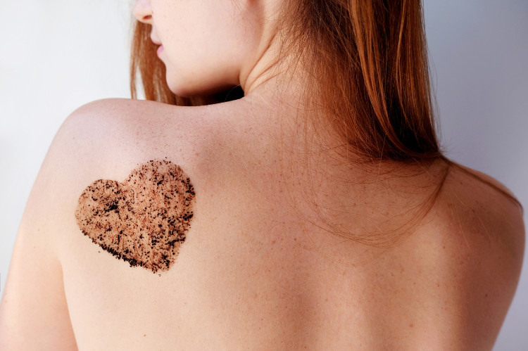 O peeling esfolia as células mortas da pele: Getty Images costas de mulher com uma descamação castanha em forma de coração na omoplata esquerda
