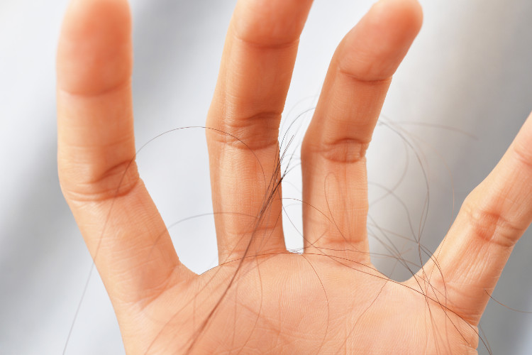 A queda excessiva de cabelo é um problema: Getty Images mão com cabelo a cair
