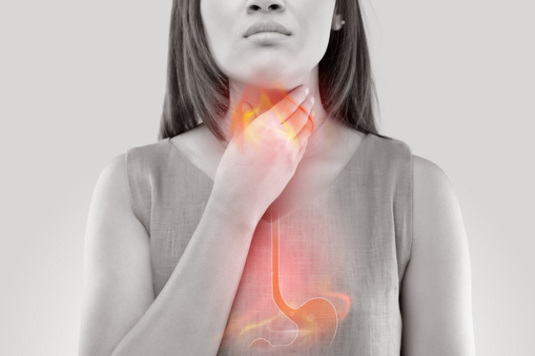 Refluxo gastroesofágico (azia) Fonte: Getty Images mulher a segurar o pescoço para a azia