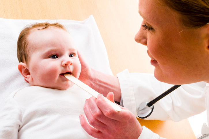 A difteria pode ser facilmente confundida com angina. Foto: Thinkstock bebé com a boca aberta, a mãe a olhar para a sua garganta com um martelo