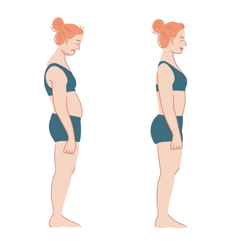 Esquerda: postura para a frente das articulações do pescoço e dos ombros, lordose cervical e cifose torácica excessivas, parede abdominal relaxada, lordose excessiva da coluna cervical e semiflexão dos músculos glúteos. Direita: postura fisiológica: Getty Images Postura