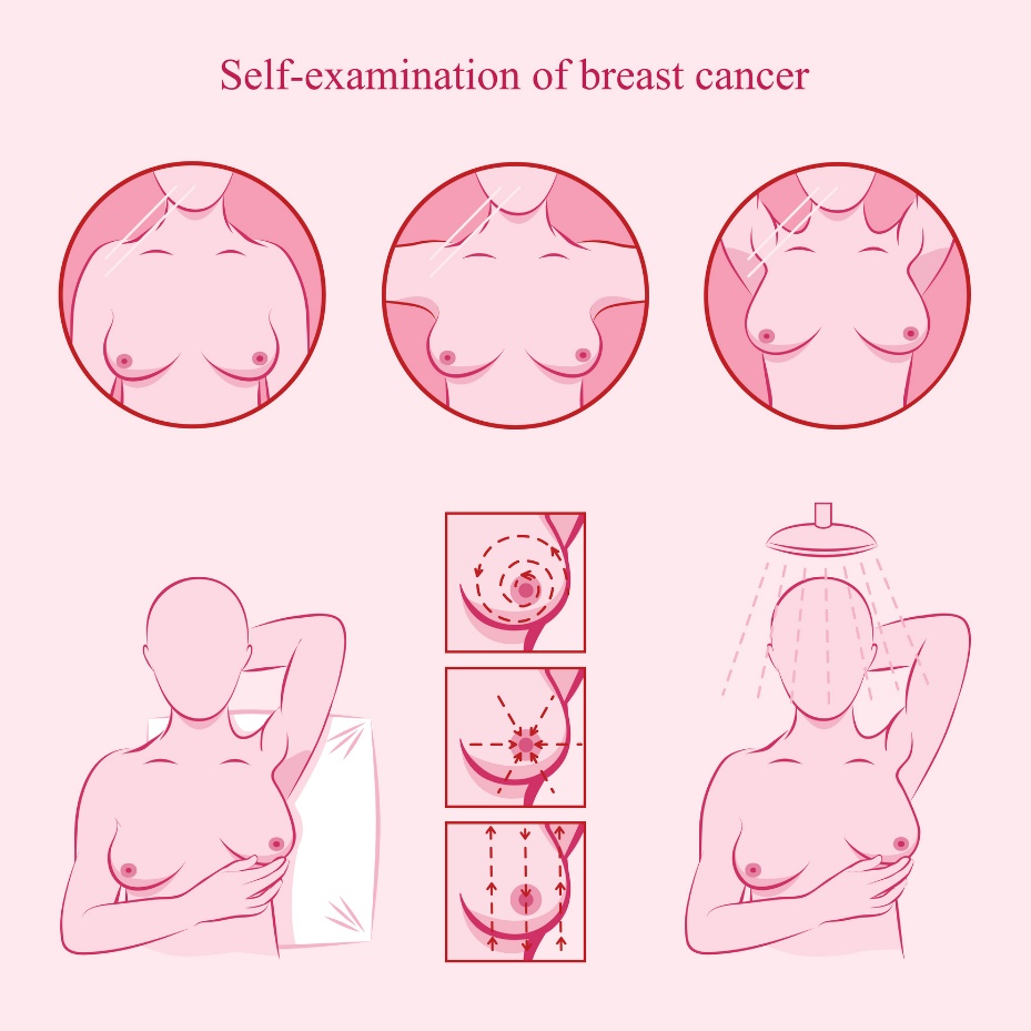 Ilustração do auto-exame da mama como prevenção do cancro da mama. Fonte: Getty Images Ilustração do auto-exame do peito