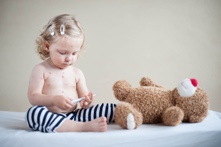 O sarampo surge em crianças não vacinadas. Foto: Thinkstock uma criança com sarampo brinca com um ursinho de peluche