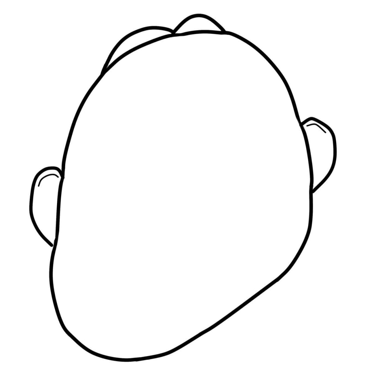 Deformidade da cabeça numa criança com achatamento lateral em plagiocefalia Fonte. Plagiocefalia da cabeça numa criança