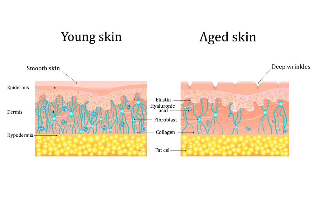 Pele jovem e idosa: Epiderme (pele), Derme (pele), Hipoderme (tecido subcutâneo), Rugas profundas, Elastina, Ácido hialurónico, Fibroblastos (tecido conjuntivo), Colagénio e células adiposas: Getty Images Pele em idade jovem e em idade avançada