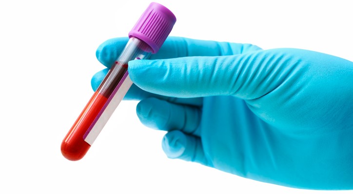 Também importante: uma análise bioquímica ao sangue: Getty Images Análise de sangue, sangue num tubo, luva azul na mão