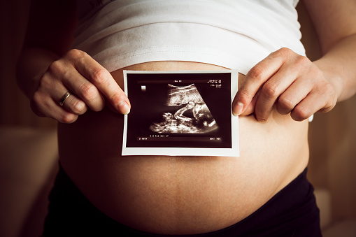 Período pré-natal Foto: Getty Images Mulher grávida segurando uma ecografia com a imagem de um bebé